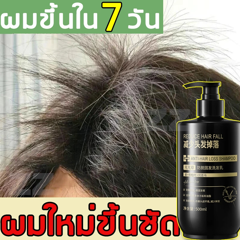ปรับปรุงสภาพเส้นผม แชมพูแก้ผมร่วง 500ML บำรุงรากผม ปรับปรุงคุณภาพเส้นผม บำรุงผม เร่งผมยาว แชมพูเร่งผมยาว ยาสระผมแก