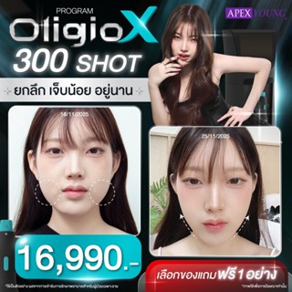 [E-Voucher] APEX โปรแกรม Oligio X หน้าเรียว หน้ายุง 300 Shot…