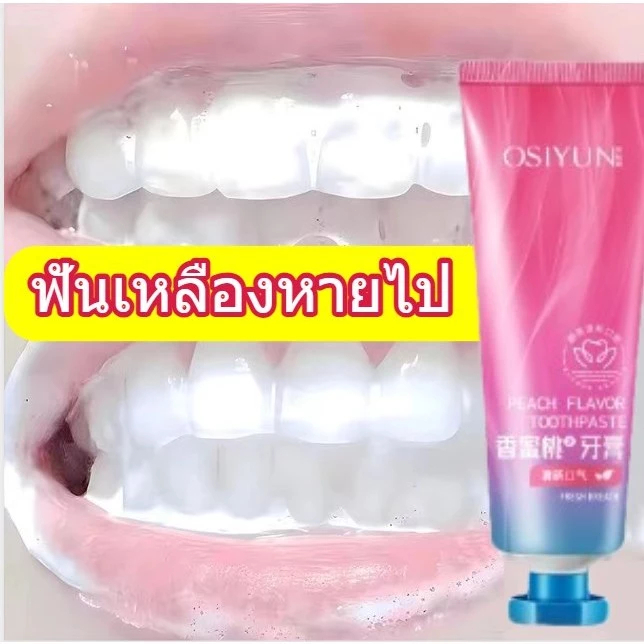 ยาสีฟันฟอกสีฟัน ไวท์ฟันเทนนิ่ง ยาสีฟัน บรรเทากลิ่นปาก ลมหายใจสดชื่น น้ํายาล้างหินปูน การดูแลช่องปากประจ