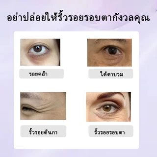 เรตินอลอายครีม ครีมทาใต้ตา Eye Cream Anti-Aging อายครีม35g ลดริ้วรอย ลดถุงน้ำใต้ตา ลดรอยคล้ําใต้ตา ลดริ้วรอยตีนกา ให้คว