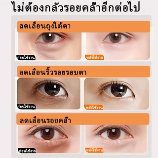 เรตินอลอายครีม ครีมทาใต้ตา Eye Cream Anti-Aging อายครีม35g ลดริ้วรอย ลดถุงน้ำใต้ตา ลดรอยคล้ําใต้ตา ลดริ้วรอยตีนกา ให้คว