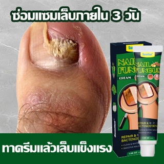 🔥7วัน ซ่อมแซมเล็บเสียอย่างรวดเร็ว🔥 เซรั่มบำรุงเล็บ ซ่อมแซมเล…