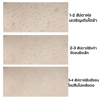 ครีมกำจัดขน สเปรย์กำจัดขน มูสกำจัดขน100g กำจัดขน ใน 5นาที กำจัดขนรักแร้ กำจัดขนแขน น้องสาวเนี ไม่ทำร้ายผิว ไม่เหลื