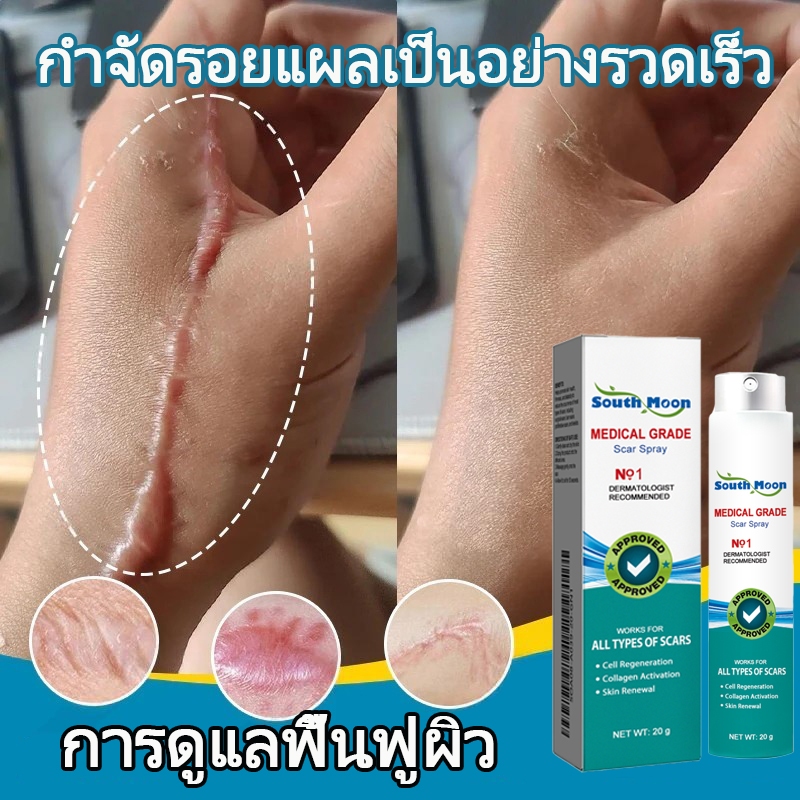 【100%ของแท้】South Moon สเปรย์ลบรอยแผลเป็น 20g เจลลดรอยแผลเป็น ครีมทาแผลเป็น แผลไฟไหม้ รอยสิว รอยแตกล