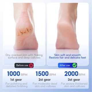 MeeGoo เครื่องขัดส้นเท้าไฟฟ้า แบบพกพา ปรับ 3 ระดับ จอ LED Electric Foot Scrubber Foot Grinder