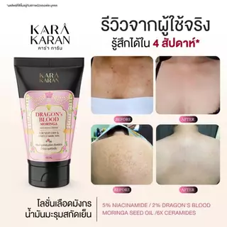 โลชั่นดราก้อนบลัด 5% Niacinamide ลดเลือนจุดด่างดำ รอยดำจากการเกา สีผิวไม่สม่ำเสมอ 120มล.