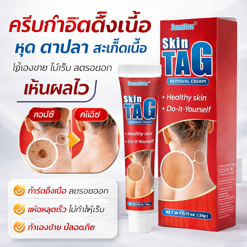 ครีมดูแลผิวสำหรับติ่งเนื้อและหูด ช่วยให้ผิวเรียบเนียน ลดรอยไม่เรียบ ซึมไว ใช้ง่าย