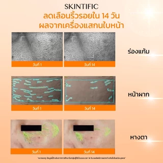 SKINTIFIC- เรตินอล เซรั่ม เซรั่มผลัดเซลล์ผิวใหม่ Retinol Essence Skin Renewal Serum 20ml