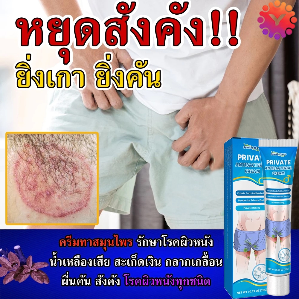 💫ครีมทาสังคัง สะเก็ดเงินครีม ครีมบำรุงผิว 20g รอยแดง โรคผิวหนัง เกลื้อน กลาก คัน สมุนไพร แก้คันเรื้อรัง คันในร่มผ้า