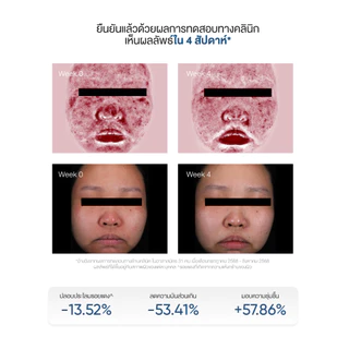 [Facerinna official] Ceramide B5 Balancing Moisturizer ครีมบำรุงผิว ฟื้นฟูผิว เสริมสร้างผิวแข็งแรง ล็อกความชุ่มชื้นa