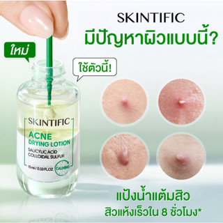 【new】SKINTIFIC Acne Drying Lotion Salicylic Acid Acne Spot Treatment bha เซรั่ม แผ่นแปะสิว ลดรอยสิว เซรั่มสตอ ลดสิว 10ml