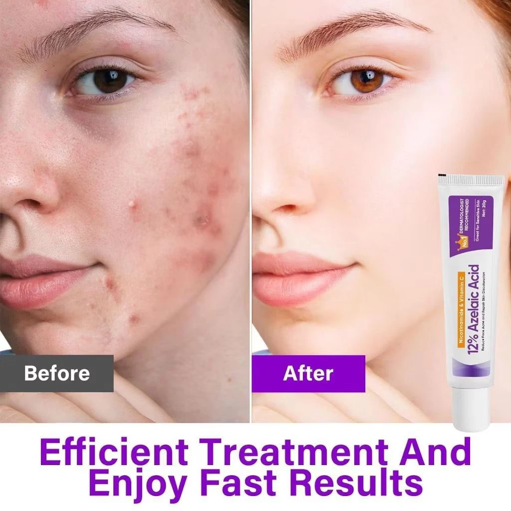 เจลลดสิว Azelaic Acid 12% ผสาน Niacinamide และ Vitamin C thumbnail 6