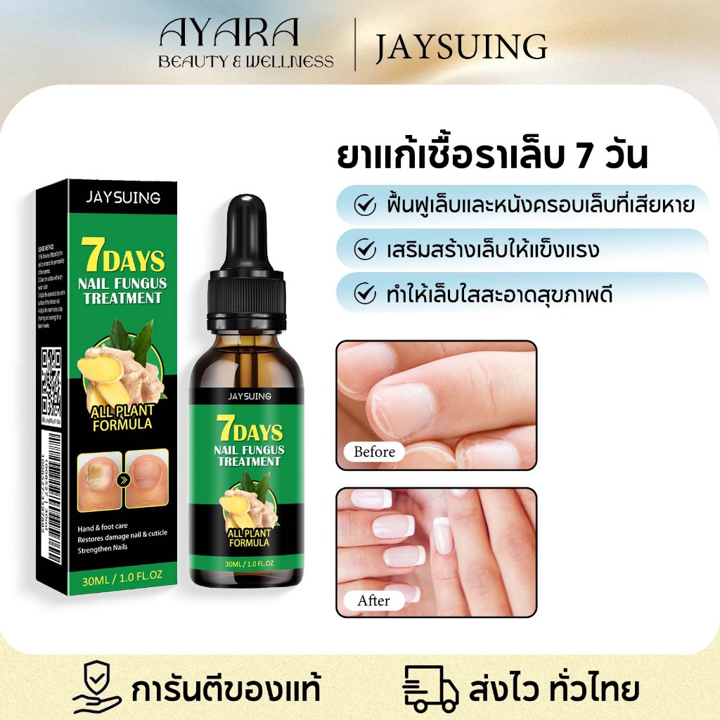 Jaysuing น้ำยารักษาเชื้อราที่เล็บ น้ำยาฟื้นฟูเล็บ เซรั่มฟื้นฟูเล็บ ฆ่าเชื้อรา เพื่อรักษาเชื้อรา 30ml