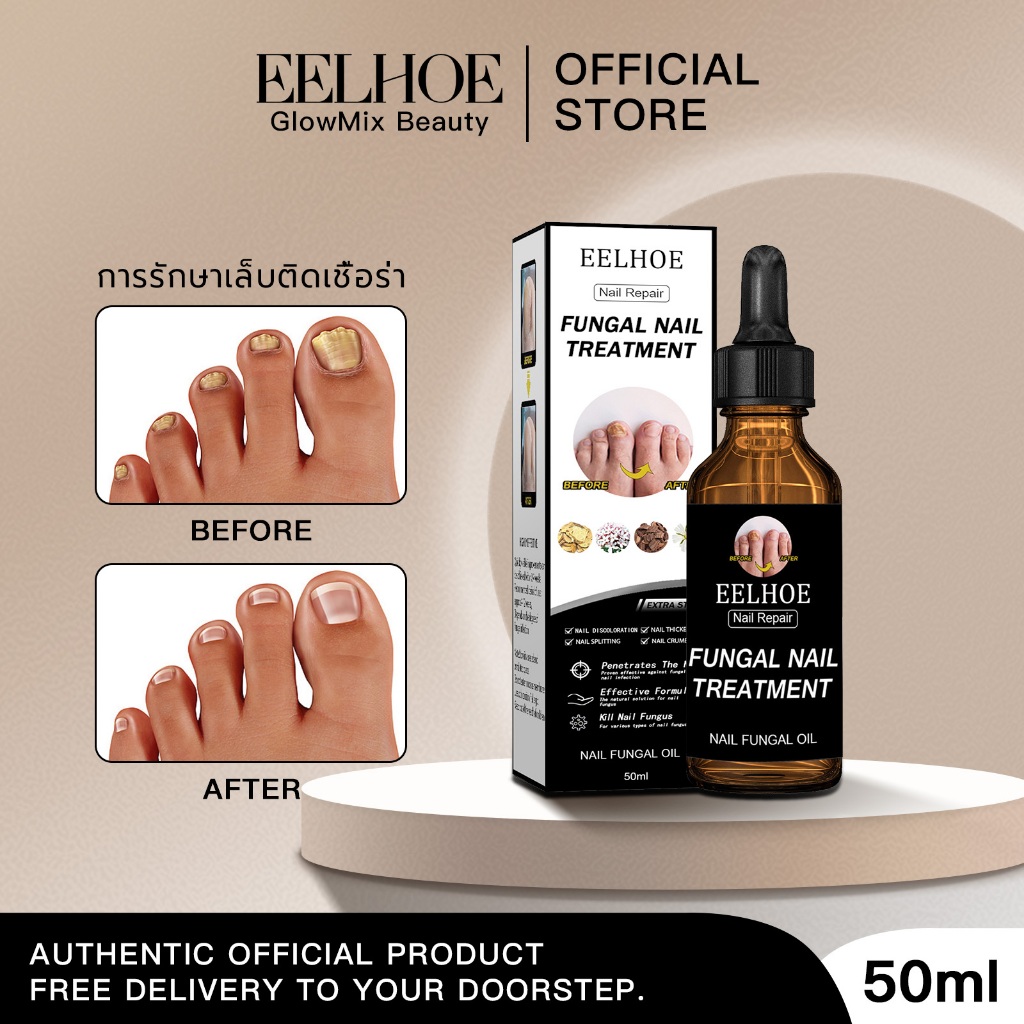 EELHOE น้ำยาปรับเล็บขบ ยาหยอดเล็บขบ ซ่อมแซมเล็บ