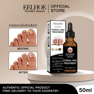 EELHOE น้ำยาปรับเล็บขบ ยาหยอดเล็บขบ ซ่อมแซมเล็บ