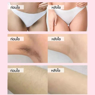 🔥 [เห็นผลไว] ครีมกำจัดขน 60g |มูสกำจัดขน อ่อนโยน ไม่เจ็บปวด ใช้ได้ทั่วร่างกาย ขา แขน รักแร้ จุดซ่อนเร้น พร้อมผิวเนียนนุ่