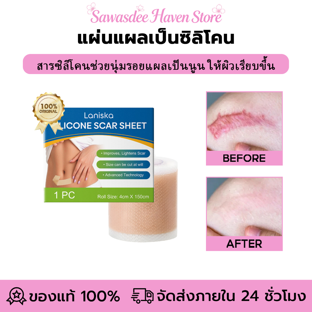 Laniska แผ่นแผลเป็นซิลิโคน ซิลิโคนลดรอยแผลเป็น แผ่นแปะแผลเป็น ซ่อมแซมรอยแผลเป็น ลดรอยแผล รอยแผลผ่าตัด