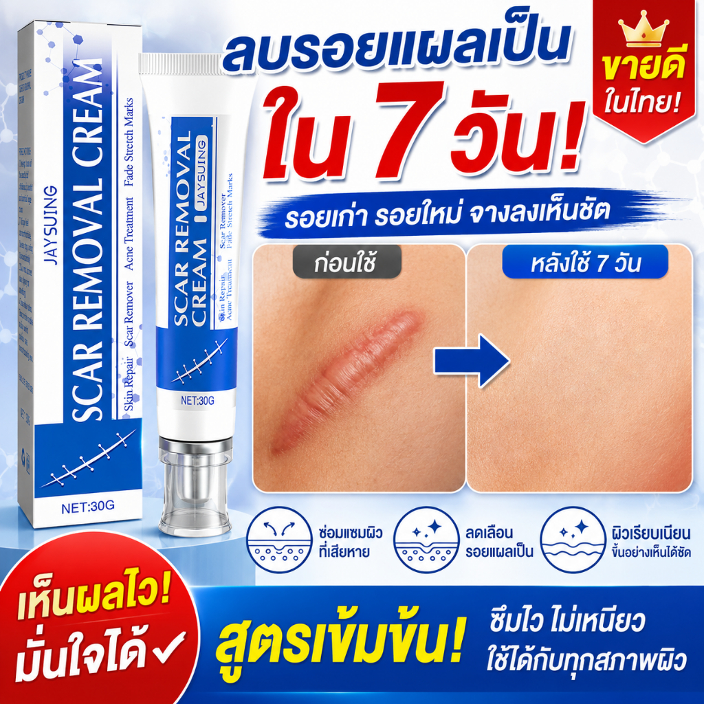 ครีมลดรอยแผลเป็น แผลเป็น รแผลไฟไหม้ น้ำร้อนลว แผลผ่าตัด รอยแตกลายหลังครรภ์ แผลเป็นใหม่และแผลเป็นเก่า 30g