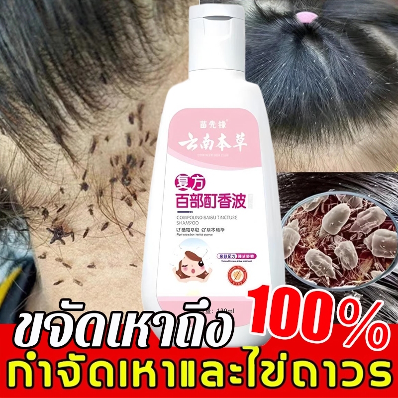[กำจัดเหาใน1วิ] แชมพูฆ่าเหา 120ml สารสกัดจากธรรมชาติ ยาสระผมฆ่าเหา ยาฆ่าเหา แชมพูเด็ก เหาตาย ไข่ฝ่อ ปลอดภัย 1ขวบใช้ได้