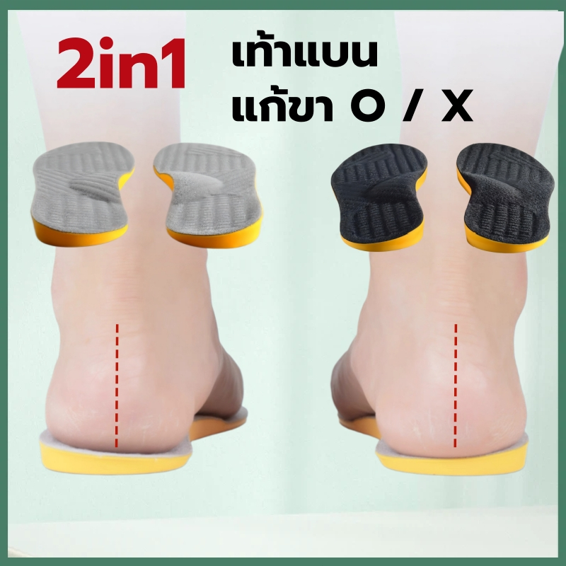 【ซื้อ 1 คู่ แถม 1 คู่】พื้นรองเท้าเสริมเท้าแบน - รองรับส่วนโค้งสําหรับขารูปตัว O/X และบรรเทาอาการปวดพังผืดฝ่าเท้า