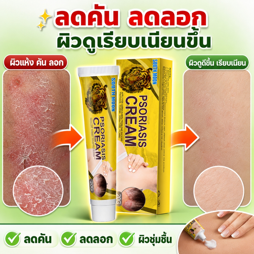 🔥[คันแค่ไหนก็เอาอยู่]🔥 ครีมรักษากลากเกลื้อน ต้านเชื้อรา ลดคัน ลดลอก ลดแดง ฟื้นฟูผิวแข็งแรง