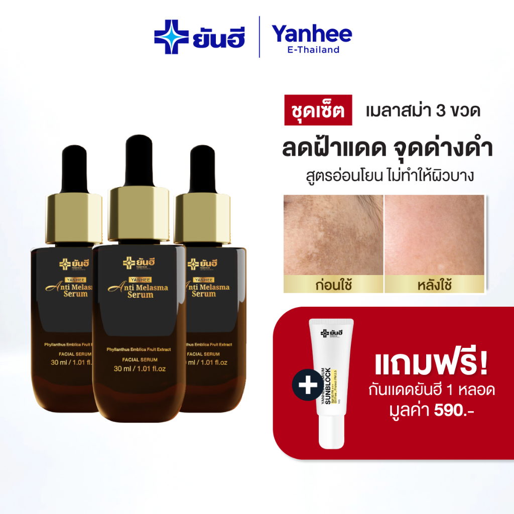 Yanhee Anti Melasma Serum ยันฮี แอนตี้ เมลาสม่า เซรั่มเวชสำอาง ลดฝ้า กระ จุดด่างดำ ขนาด 30ml.