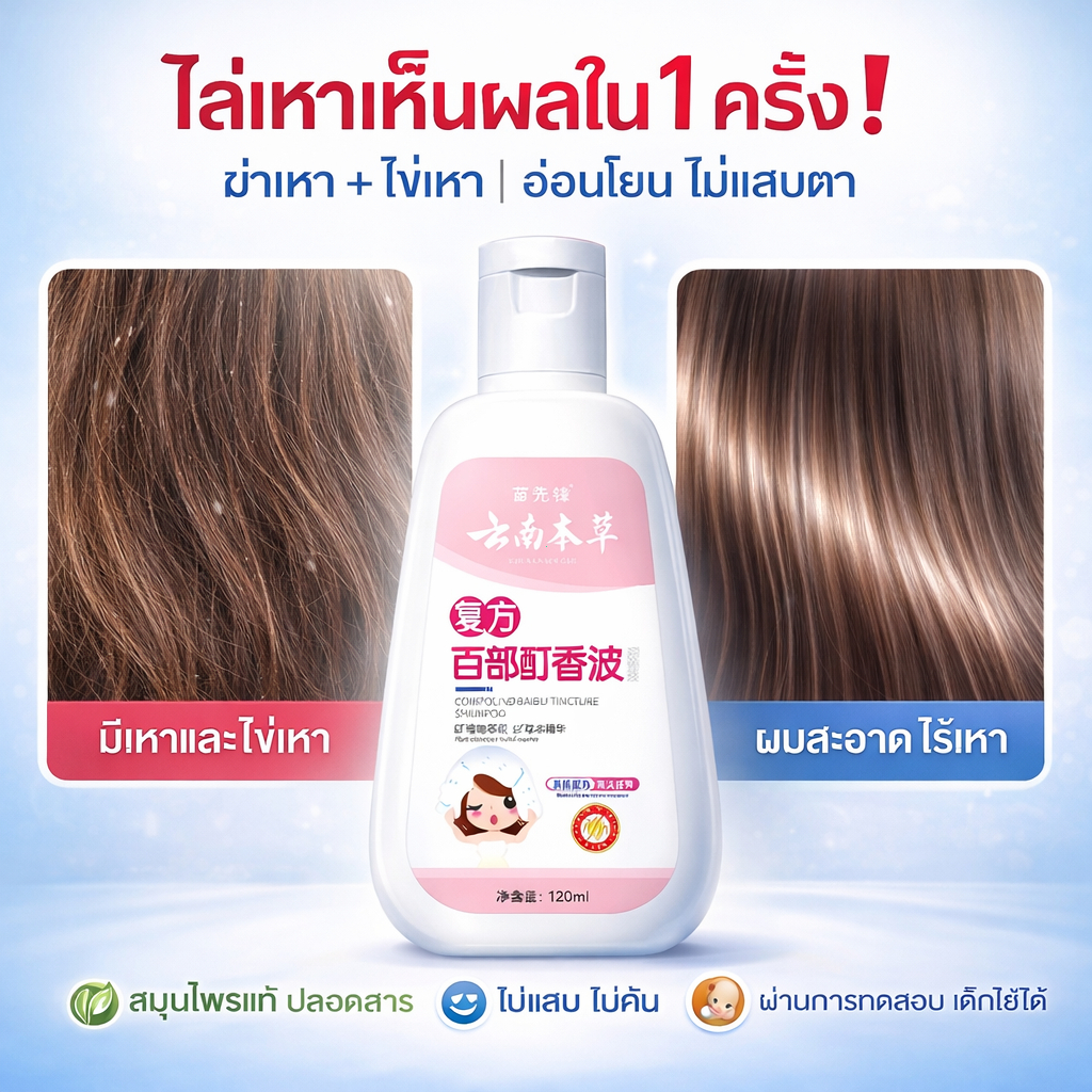 【พร้อมส่ง】แชมพูกำจัดเหา สมุนไพร ฆ่าเหาและไข่เหา 99% เห็นผลไว หยุดคันใน 5-10 นาที ใช้ได้ทั้งเด็กและผู้ใหญ่