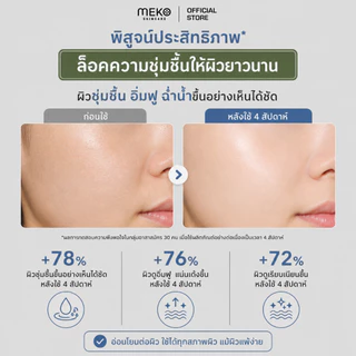 เจลนวดหน้า สูตรไฮยาลูโรนิค ใช้ที่เมโกะ คลินิก Meko Clinic ใช้กับเครื่องนวดหน้าได้ทุกรุ่น ขนาด 200 ml