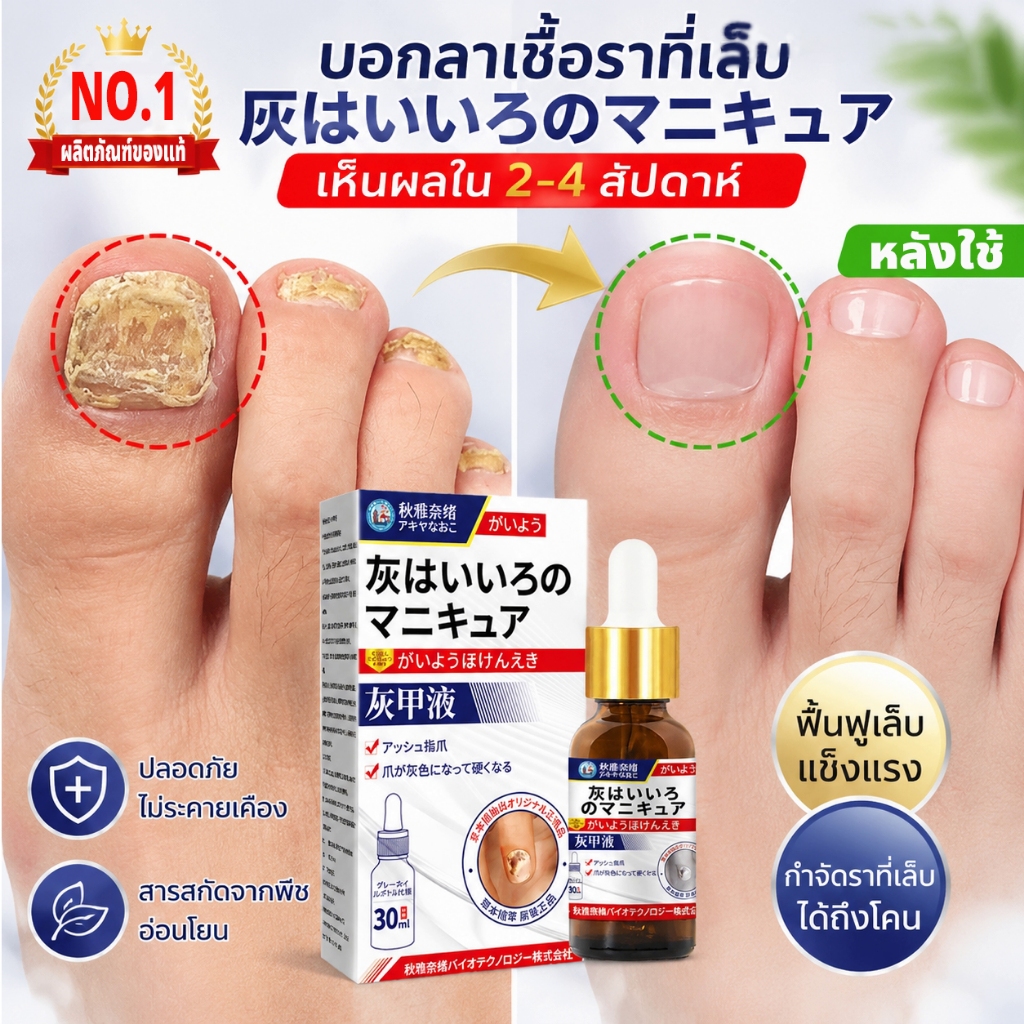 เล็บ ขบ รักษา nail repair serum เชื้อราเล็บ ซ่อมแซม และต่ออายุเล็บที่เสียหาย เล็บแตก และเปลี่ยนสีได้