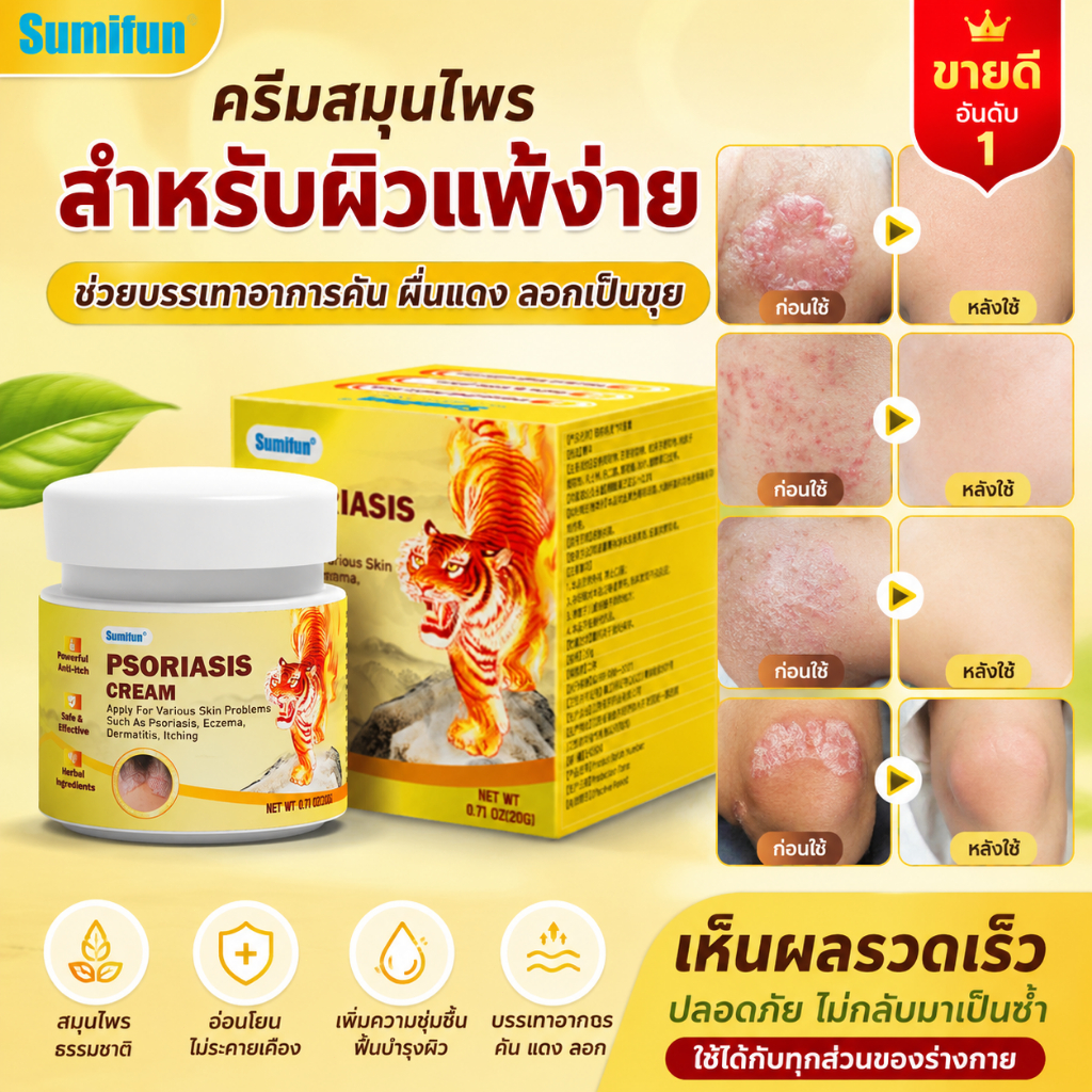 Sumifun ครีมสมุนไพร ลดผิวแพ้ง่าย รักษาผื่นสะเก็ดเงิน กลาก คัน แห้งลอก ใช้ได้ทุกส่วนของร่างกาย
