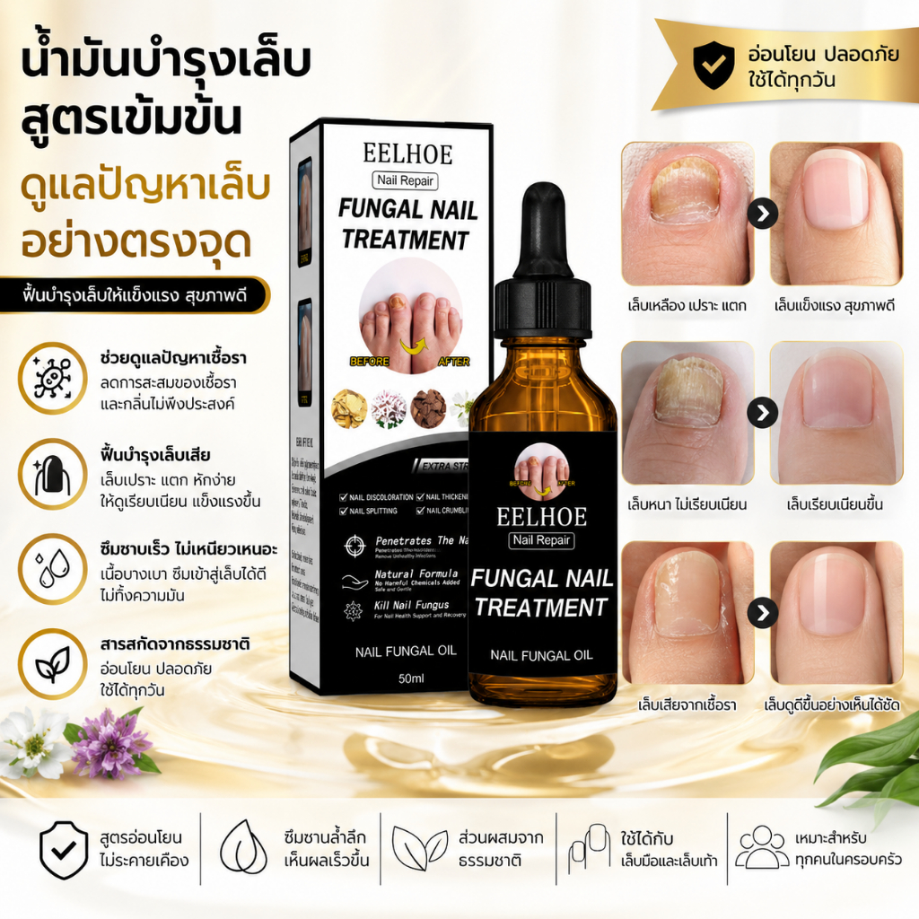 น้ำมันบำรุงเล็บ EELHOE 30ml | ดูแลเล็บแห้งเสีย เล็บเปราะบาง | เพิ่มความชุ่มชื้นให้เล็บและจมูกเล็บ | ซึมไว ใช้งานง่าย