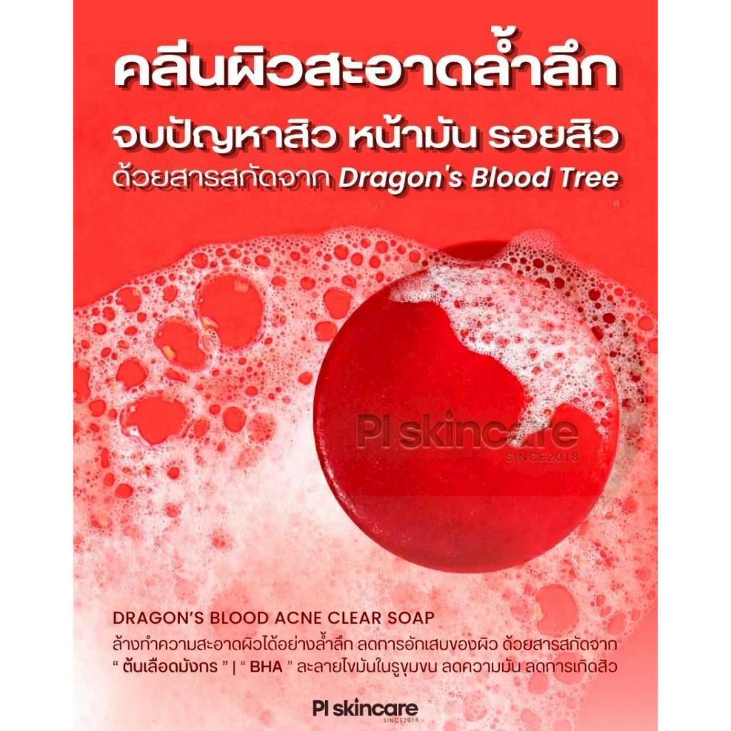(ชุด 2 ก้อน)สบู่ลดสิว สบู่ล้างหน้า ควบคุมความมัน สบู่เลือดมังกร ปราบสิว กู้หน้าพัง