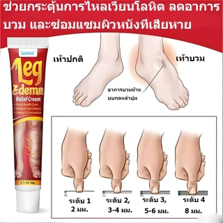 ครีมลดอาการบวมที่ต้นขา ครีมบรรเทาอาการบวมที่ขา ครีมลดอาการบวมที่ขา ออกฤทธิ์เร็ว เหมาะสำหรับลดอาการบวมที่ขาและข้อเท้า