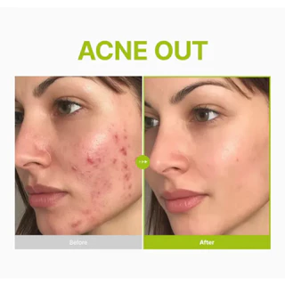 แท้💯ส่งไว🚀 PURITO AZELAIC ACID 10 KOJIC TEA TREE SERUM 30ML เซรั่มลดสิว คุมมัน ผิวใส