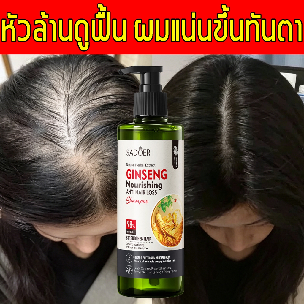 แชมพูโสม บำรุงรากผม สารสกัดจากสมุนไพรธรรมชาติ ปรับสภาพเส้นผม ลดการขาดหลุดร่วง ทำให้ผมแข็งแรง นุ่มลื่นและมีวอลลุ่ม