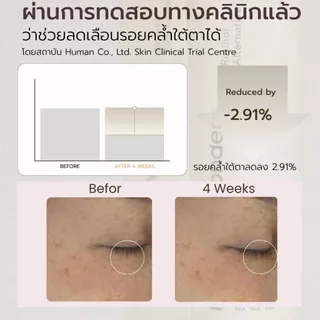 สินค้าแถมฟรีเมื่อซื้อครบ 1,190.- (Black Rice Bakuchiol Eye Cream 20 ml.) 1-31 ก.ค. 69
