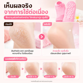 【SPA】ถุงเท้าสปา ดูแลเท้า รักษาส้นเท้าแตก ลดอาการเมื่อยล้าจากการยืนนาน สปาที่บ้าน