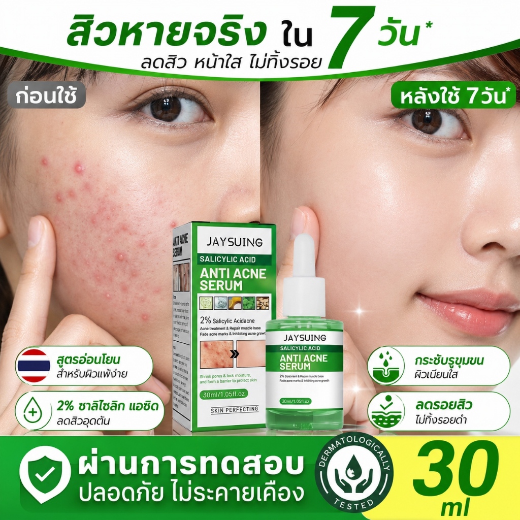 เจลแต้มรักษาสิวผสานเซรั่ม 30ml ครีมลดสิว กำจัดสิว ลบรอยสิวได้ผลดี