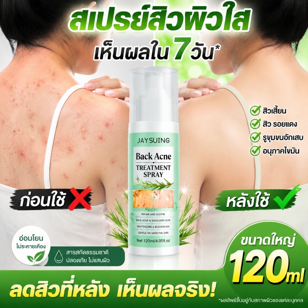 สเปรย์ลดสิวทั่วร่างกาย 120ml ขจัดแอคเน่บริเวณหลัง ลดไร ครีมแต้มสิวรักษา