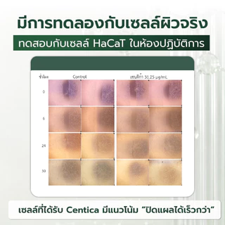 เซ็ตใหญ่สุดคุ้ม Centica 3 กระปุก + Pumpkin Juice 1 กล่อง