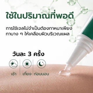 Centagel ซิลิโคนเจลเกรดการแพทย์ ลดโอกาสการเกิดรอยแผลเป็น ลดอาการคันจากแผลคีลอยด์ ลดการขยายตัวของแผลคีลอยด์ Medical Grade