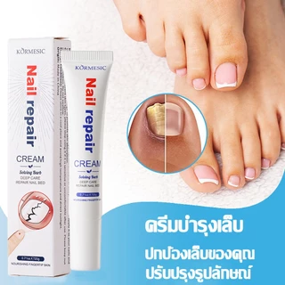 ยาทาเชื้อราที่เล็บ สำหรับดูแลเชื้อราที่เล็บ บรรเทาเล็บขบ ดูแลความสะอาดเล็บ น้ำยาบำรุงเล็บ เชื้อราที่เล็บ