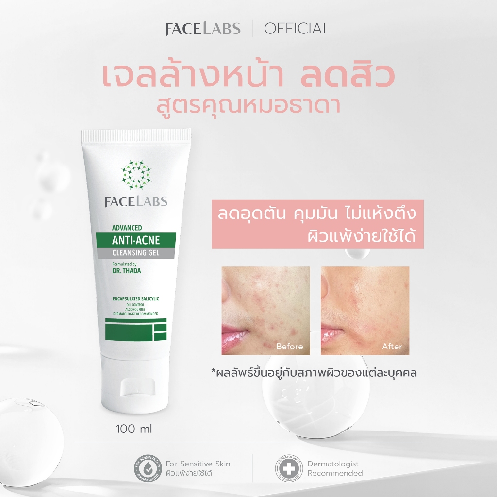 เจลล้างหน้าลดสิว สูตรคุณหมอ FACELABS Advanced Anti-Acne Cleansing Gel 100 ml คลีนซิ่ง คุมมัน ลดสิว ผิวแพ้ง่ายใช้ได้