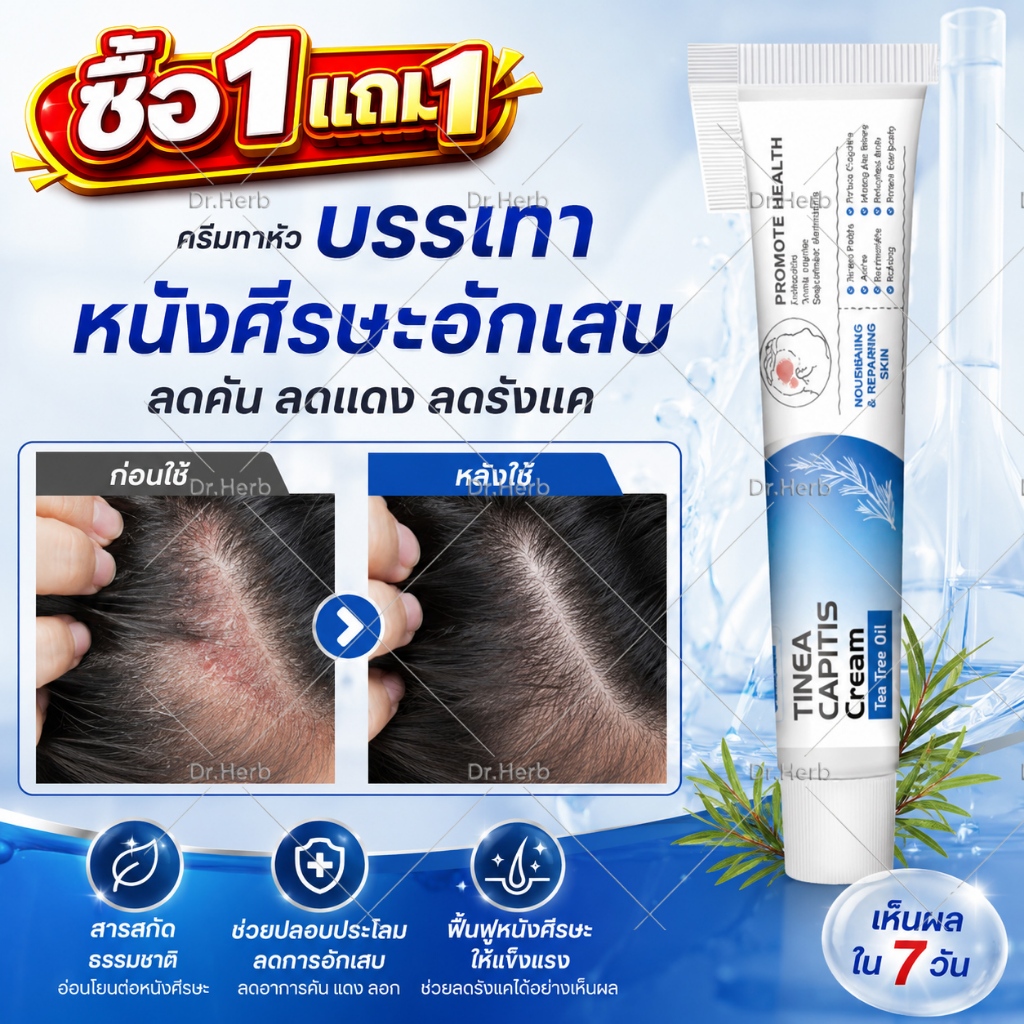 🔥ซื้อ1แถม1🔥ครีมทาสังคัง สะเก็ดเงินครีม ครีมบำรุงผิว 20g รอยแดง โรคผิวหนัง เกลื้อน กลาก คัน สมุนไพร แก้คันเรื้อรัง คันในร