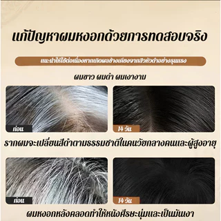 🔥ซื้อ 1 แถม 1🔥เซรั่มลดผมร่วง รากผมแข็งแรง บำรุงเส้นผม ลดขาดหลุดร่วง เหมาะทั้งผู้ชายและผู้หญิง