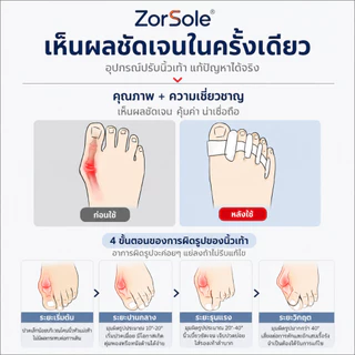 เจลแยกนิ้วเท้า 5 ช่อง จัดเรียงนิ้วเท้า ลดนิ้วเบียด orthopedic spacers