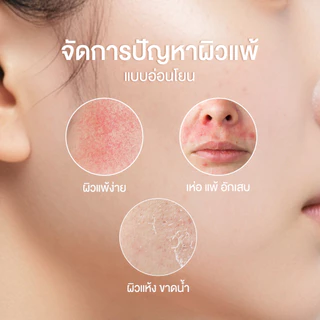 [ของแถมงดจำหน่าย] Skinsista Dear Sensitive Gel-to-Foam Cleanser เจลโฟมหน้านุ่ม 140 ml.