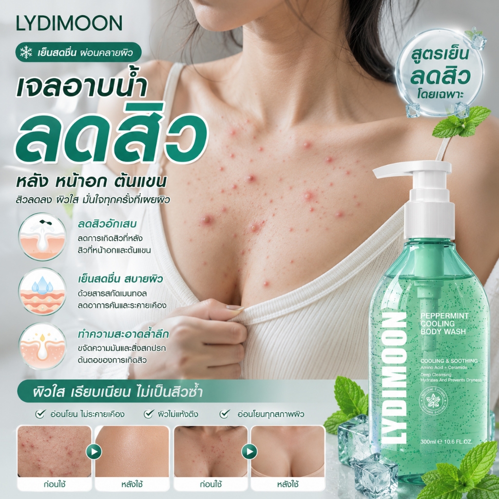 ครีมอาบน้ําลดสิว ครีมอาบน้ำมินต์เย็น ต่อต้านเชื้อราแก้คัน กำจัดไรลดสิว ลดการสะสมของแบคทีเรีย 99.8% ผิวเนียนเด้ง