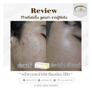ครีมลดสิว หน้าใส โอปิ๊ง สูตรเก่าดั้งเดิม - OPING WINK WINNER CREAM