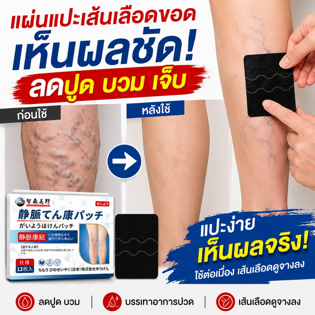 Varicose Vein Treatment Patch แผ่นแปะเส้นเลือดขอด ขาสวย ลบเส้นเลือดขอด กลับคืนสุขภาพเท้า 12ชิ้น